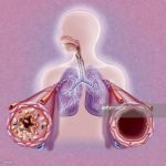 Obat Asma Ini Ternyata Mampu Mencegah Kerusakan Organ Hati