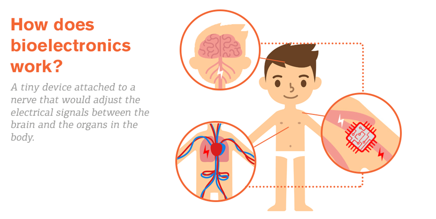 Bagaimana bioelektronik bekerja? chip memperbaiki signal antara otak dan bagian organ tubuh