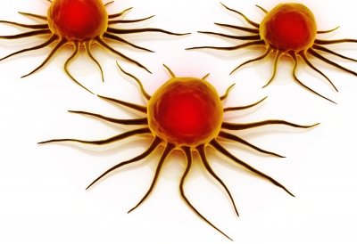 terapi kekebalan sel kanker