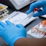 Benarkah Tomat Sebagai Pemicu Asam Urat? Ini Jawabannya