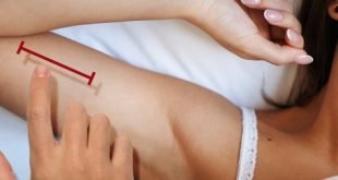 Obat Implan Pertama Untuk Kecanduan Narkoba Segera Hadir di Amerika