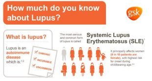 lupus