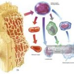 Transplantasi Sel Punca dan Polimer Berpori Efektif Sembuhkan Luka Diabetes