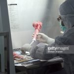 Peranan Hidrogel Berbasis Polisakarida Interpenetrasi dalam Rekayasa Jaringan