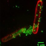 Peneliti Muda Temukan Polimer Bintang Untuk Menanggulangi Resistensi Antibiotik