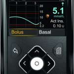 Telah Hadir Alat Penghantar Insulin Otomatis Pertama di Dunia Untuk Pasien Diabetes Tipe 1