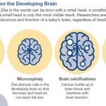 Begini Pengaruh Virus Zika Terhadap Perkembangan Otak Bayi