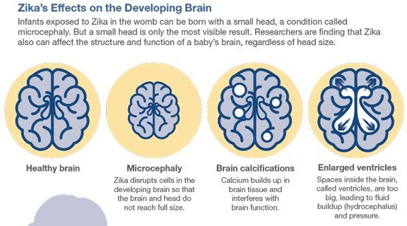 zika effect