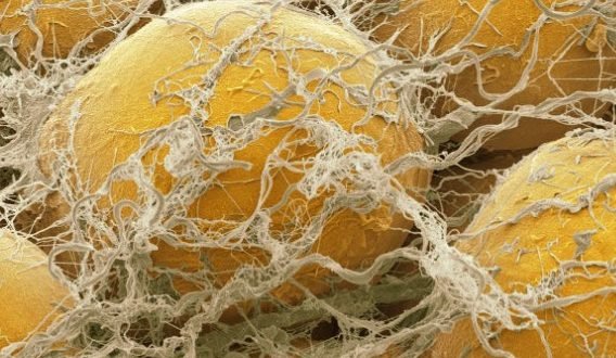 Sel-sel lemak yang dikelilingi oleh jaringan ikat, terlihat pada perbesaran ribuan kali dari ukuran mereka sebenarnya. Setiap sel lemak mengandung lipid tunggal, atau tetesan minyak. (Science Photo Library)