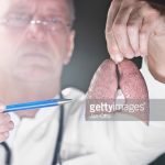 Pasien TBC yang Tidak Patuh Obat, Selain Risiko Resistensi Juga Memerlukan Banyak Biaya