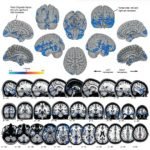 Bentuk Otak Astronot Berubah Ketika Melakukan Misi Perjalanan Ke Luar Angkasa
