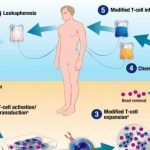 Tisagenlecleucel, Terapi Genetik Imunoseluler Pertama Untuk Leukimia Disetujui FDA