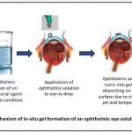 Inovasi Pengobatan Terbaru Pada Mata : In Situ Gel Opthalmic