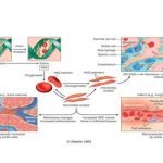 Penyakit Sel Sabit dan Mekanisme Endari (L-Glutamin) untuk Mengobatinya