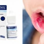 Sebabkan Efek Samping Serius, BPOM Bekukan Izin Edar Albothyl Konsentrat