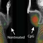 Peneliti Temukan Vaksin Kanker Baru yang Bisa Sembuhkan Tumor