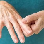 Baricitinib, Obat Baru Untuk Rheumatoid Arthritis