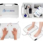 Keringat Berlebih? Atasi dengan Terapi Iontophoresis