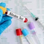 Bilirubin dan Cara Mudah Mendeteksinya Secara Elektrokimia