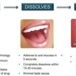 Kombinasi Kitosan-Xanthan Gum Tingkatkan Efek Mukoadhesif Sediaan Patch