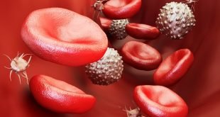 FDA Menyetujui Epcoritamab untuk Pengobatan Limfoma Folikular Kambuhan, Refraktori