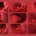 Ahli Farmakologi Jelaskan Terkait Efek Pembekuan Darah Vaksin AstraZeneca