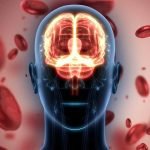 Peneliti Temukan Faktor Risiko Baru Untuk Gangguan Kardiovaskular Pada Pasien Lupus