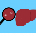 Bulevirtide Tunjukkan Khasiat Obati Hepatitis Kronis Virus Delta