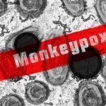Mengenal Virus Monkeypox, Pengobatan dan Pemcegahannya
