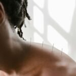 Penggunaan Akupunktur Dapat Mengurangi Risiko Stroke yang Terkait dengan Rematoid Artritis