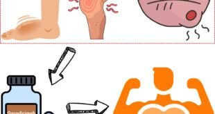 ANDEMBRY (Garadicimab): Tinjauan Komprehensif Terhadap Terapi Profilaksis Inovatif untuk Angioedema Herediter Berdasarkan Bukti Klinis dan Dunia Nyata